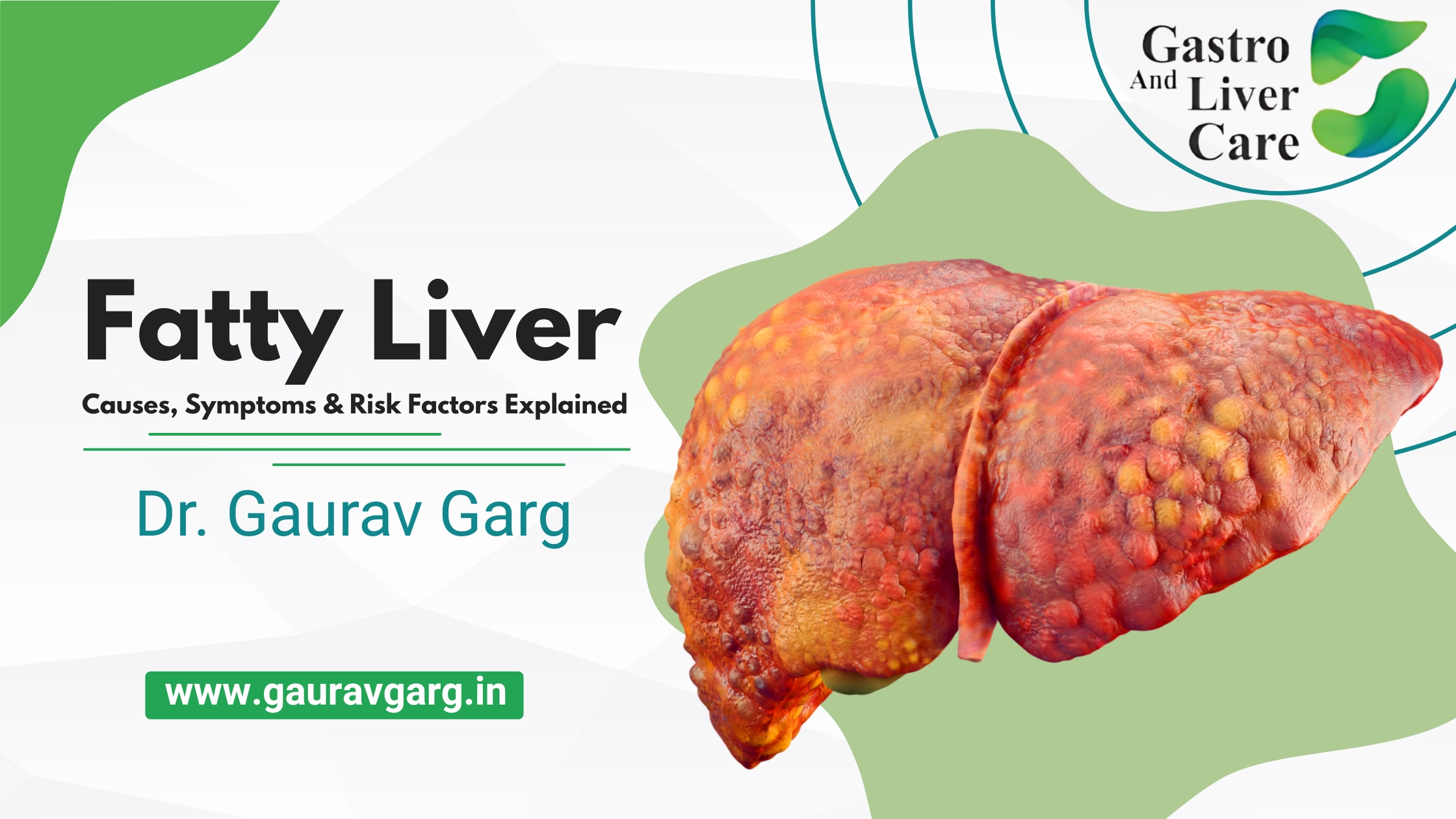 Fatty liver